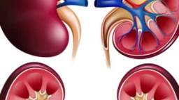Home remedies for kidney stones