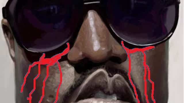How I Injured Myself - "Animated"!
