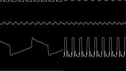 Nikku4211 - Premium Noise (2017) (Oscilloscope View)