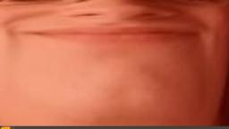 **Inhale Oxygen**