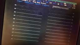 MS-DOS is The Best OS Ever!