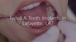 Barras Family Dentistry : Teeth Implants in Lafayette LA