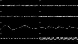 SNES - Armored Armadillo - Mega Man X | Oscilloscope View