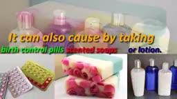 Vaginal Discharge has Returned!