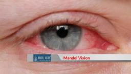 Best Manhattan Lasik - Mandel Vision (888) 866-3681