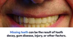 What is Reconstructive Dentistry and How Can it Help You
