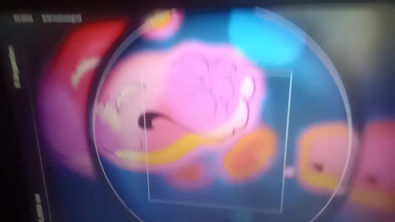 Adult Swim Commercial Break Monday, June 15, 2026 (Part 1)