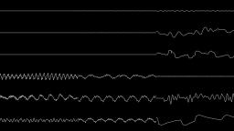 [Oscilloscope] Q2: Numbers in Circles