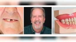 Warwick Dental Implants in Oklahoma City OK