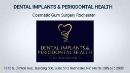 Dental Implants & Periodontal Health - Gum Surgery in Rochester, NY