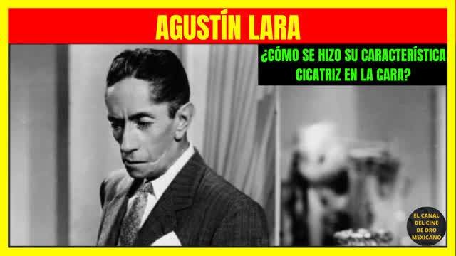 ⭐️¿Cómo AGUSTÍN LARA se hizo su característica cicatriz en la cara?⭐️