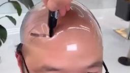 balding people in china