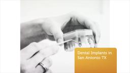 The Smile Institute | The Best Dental implants in San Antonio TX