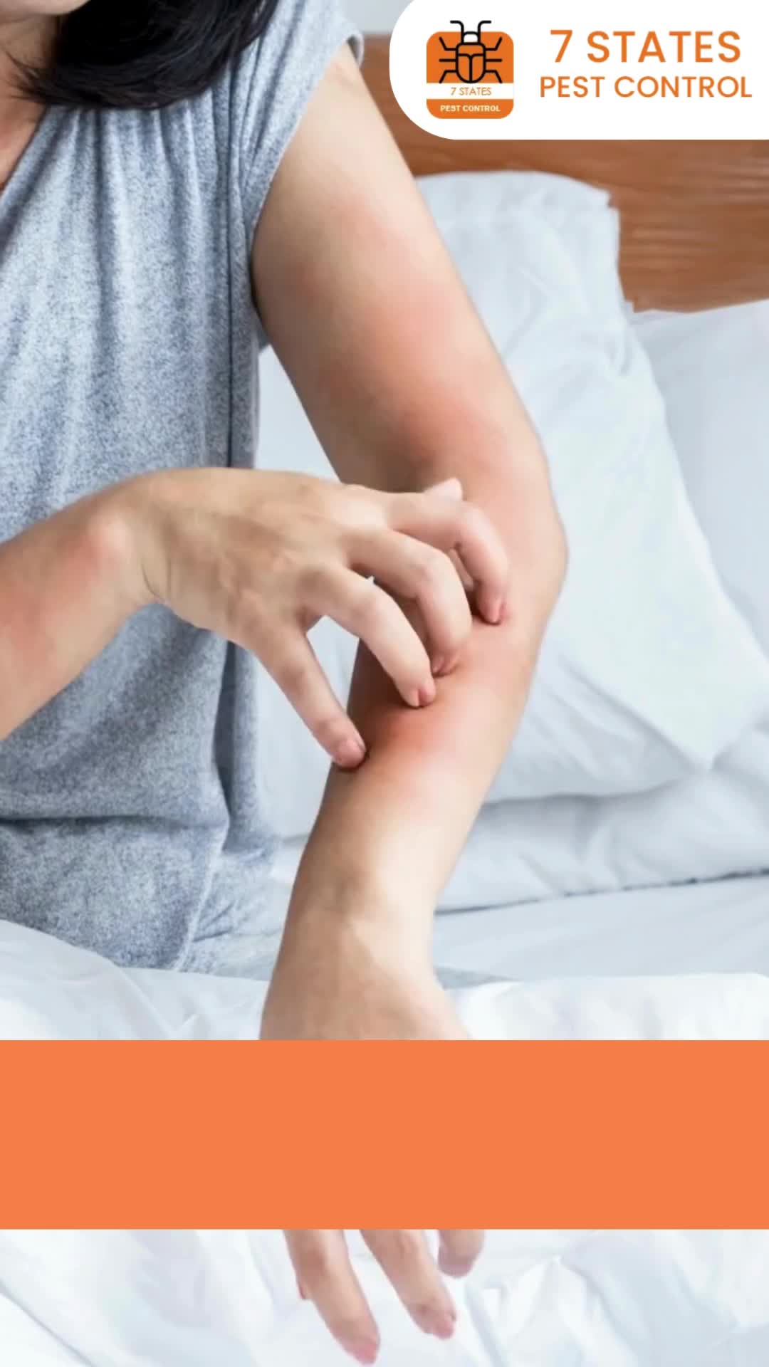 Waking up with itchy bites or red marks on your skin?