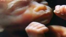 Aborto: El Desvanecimiento de la Vida