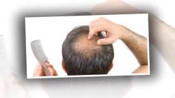 Hair Restoration Marlton - Pistone Hair Restoration (888) 260-3270