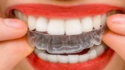 North Tampa Dentists Answer Questions About Invisalign