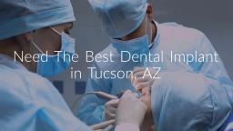 Saeid Badie, DDS : Best Dental Implant in Tucson