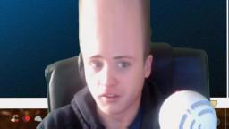 lewis has a big forehead