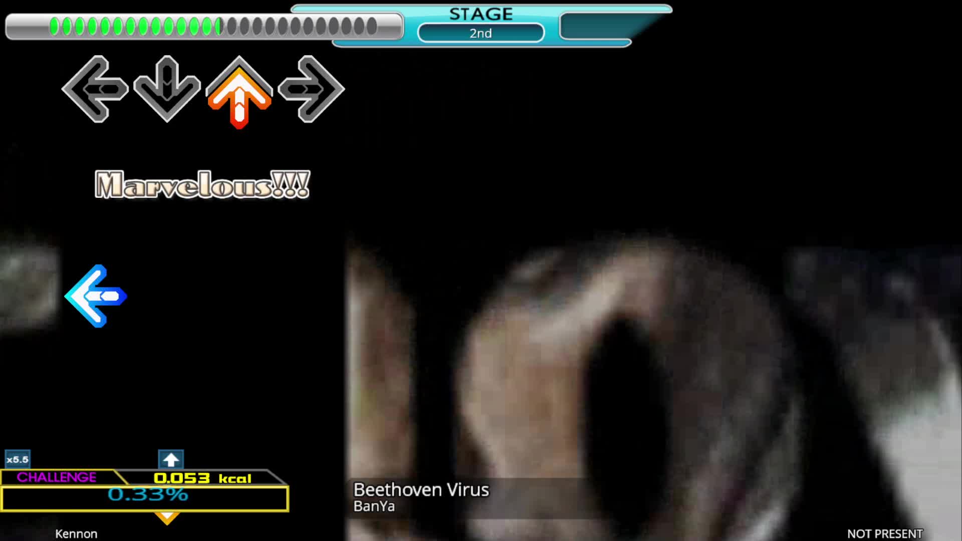 Beethoven virus DDR