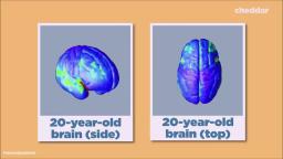 Teens decisions are often driven by rash emotions and impulse rather than by logic