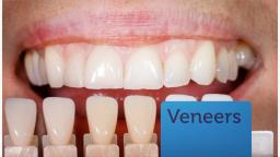 Ocala Dental Harmony - Dental Clinic Ocala FL