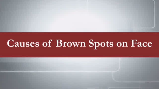 Causes of Brown Spots on Face