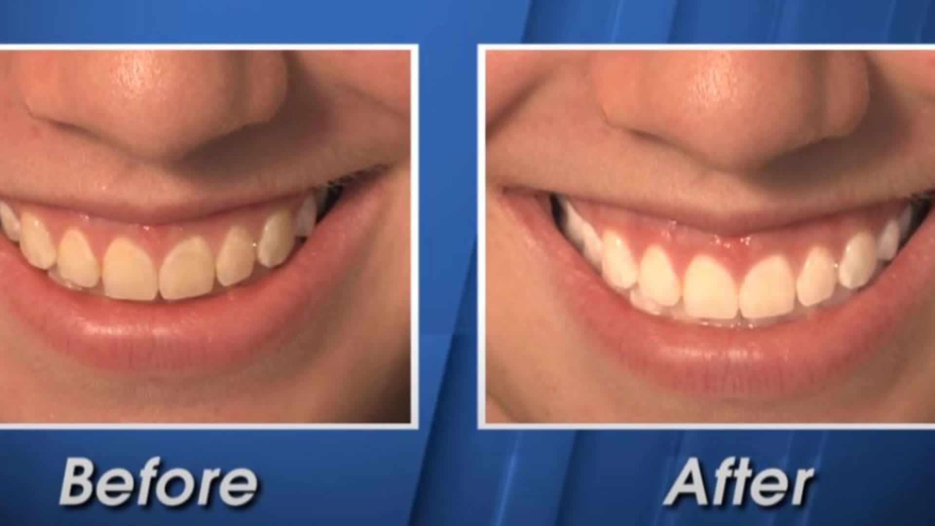 Florida Dental Care of Miller | Best Teeth Whitening Miami, FL