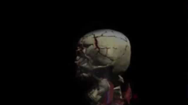 Mortal Kombat X-Ray en la vida real (prueba)