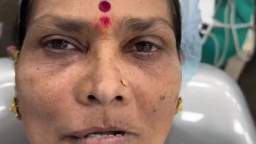 Full Mouth Rehabilitation Treatment in Vashi