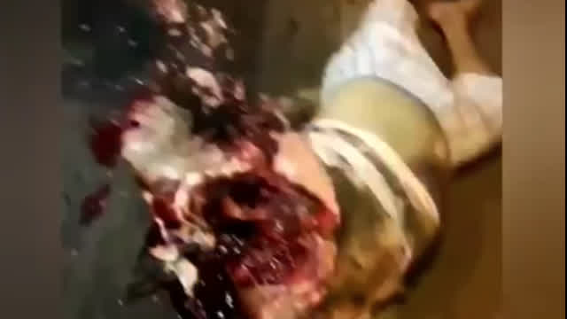 gore mix from bestgore.fun