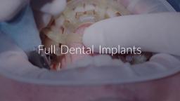 Grandridge Full Dental Implants