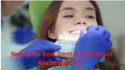 DENTAL IMPLANTS & PERIODONTAL HEALTH | Best Dental Implant in Rochester, NY