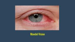 Best Lasik Manhattan - Mandel Vision (888) 866-3681