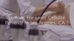 Laser Cellulite Removal By Los Angeles Liposuction Centers