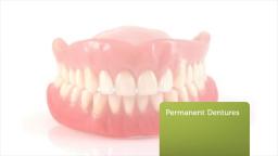 Permanent Dentures By Marco Dental Care