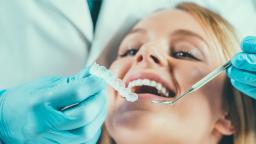 Cosmetic Dental Procedures to Transform Your Smile