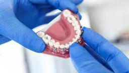 Teeth Reshaping: Pros, Cons, and Who Might Need It