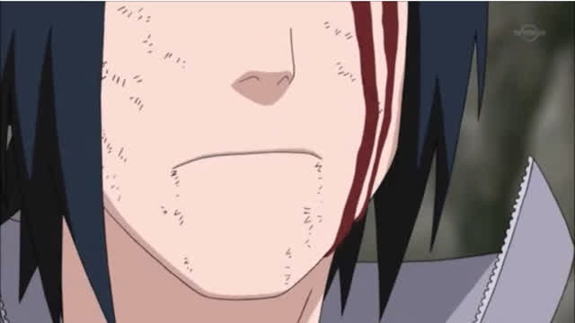 WHAT DO YOU MEAN YOU DON'T AGREE WITH SASUKE?!