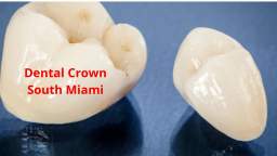Paya Dental - Dental Crown in South Miami, FL