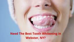 Empire Dental Care - Professional Tooth Whitening in Webster, NY