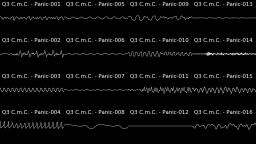 [Oscilloscope] Q3: C.m.C. - Panic