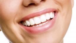 FAQs About Whitening Your Teeth