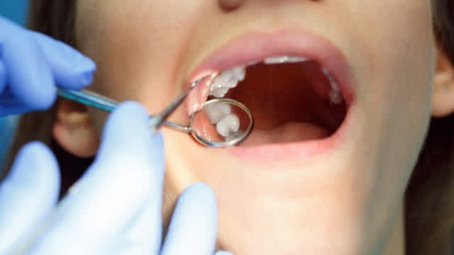 Top Reasons Why Root Canal Shouldn’t Be Avoided