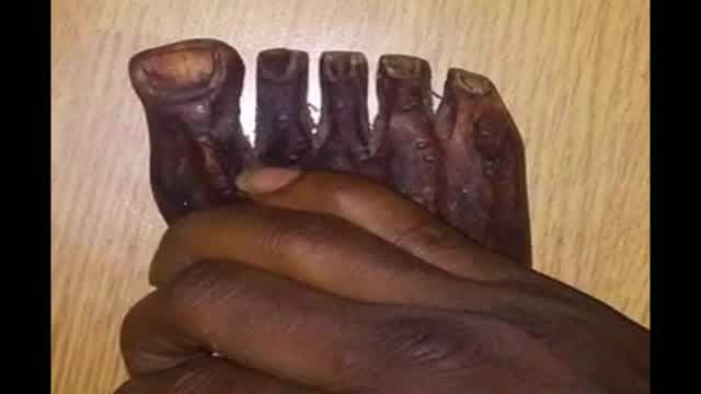 gun nails