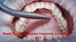 Empire Dental Care | Crown Implants in Webster, NY